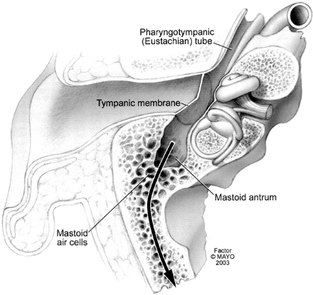 Fig 3.