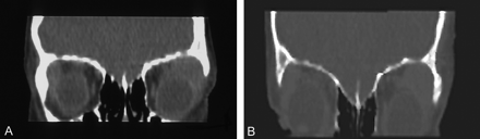 Fig 1.