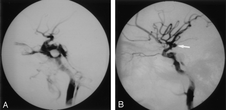 Fig 3.