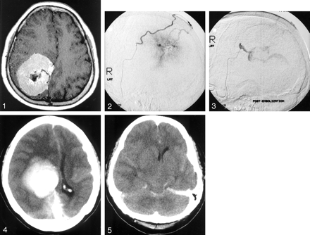 Fig 5.