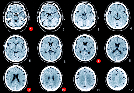 Fig 1.