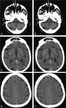 Fig 1.