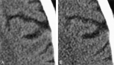 Fig 2.