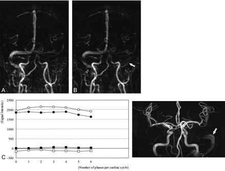 Fig 2.