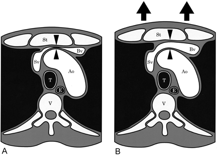 Fig 4.