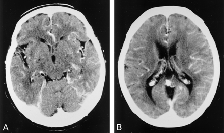Fig 3.