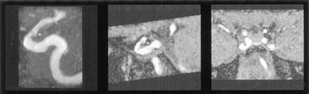 Fig 11.