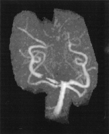 Fig 8.
