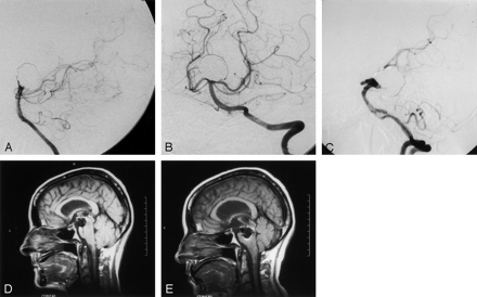 Fig 2.