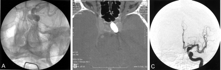 Fig 3.