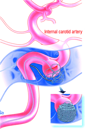 Fig 5.
