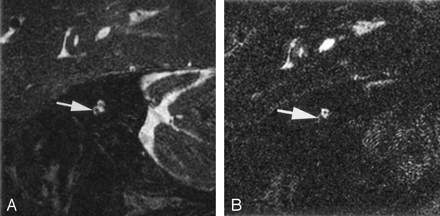 Fig 2.