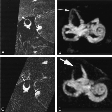 Fig 4.