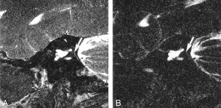 Fig 6.