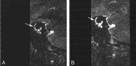Fig 7.