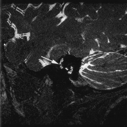 Fig 8.