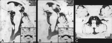 Fig 1.