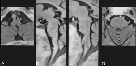 Fig 2.