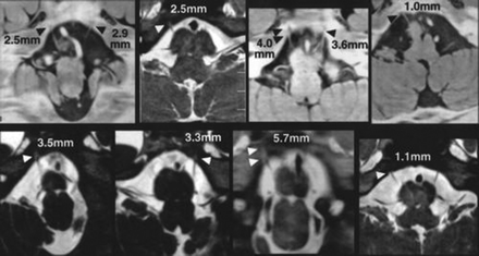 Fig 3.
