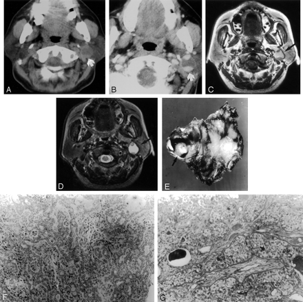 Fig 2.