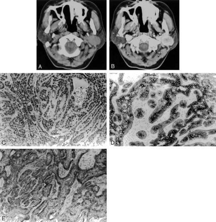 Fig 3.