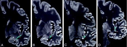 Fig 6.