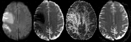 Fig 3.
