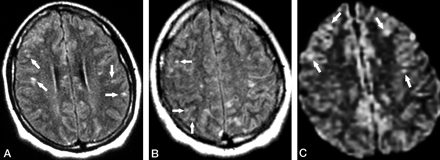 Fig 2.