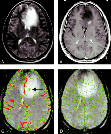 Fig 2.