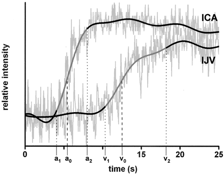 Fig 3.