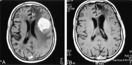 Fig 4.