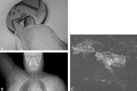 Fig 1.