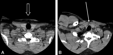 Fig 2.