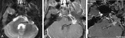 Fig 3.