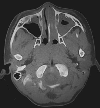 Fig 1.