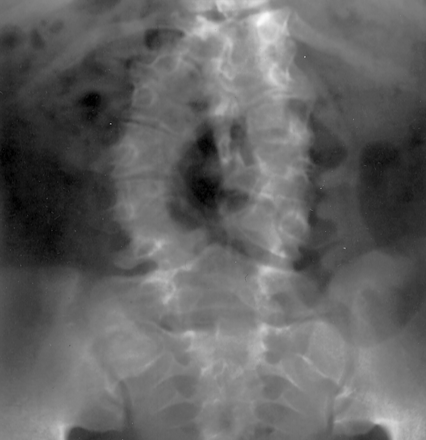 Fig 2.