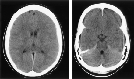 Fig 1.
