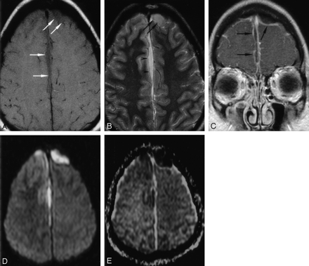 Fig 1.