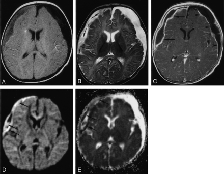 Fig 2.