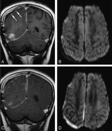 Fig 3.