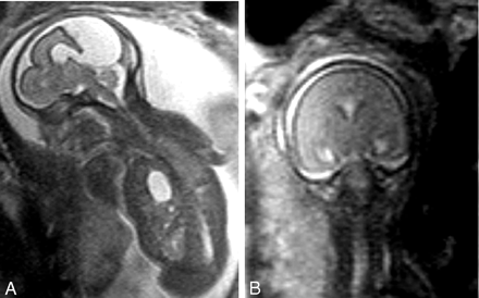 Fig 1.