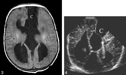 Fig 4.