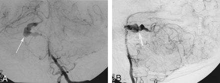 Fig 2.