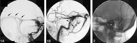 Fig 2.