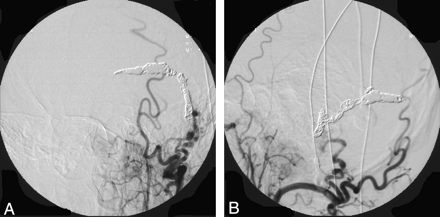 Fig 4.