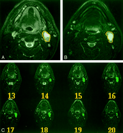 Fig 2.