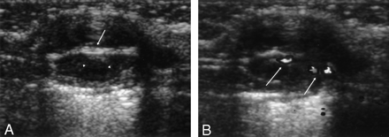 Fig 1.