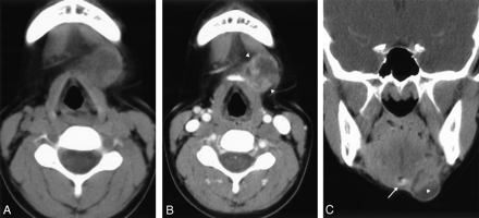 Fig 2.