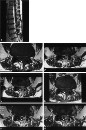Fig 3.
