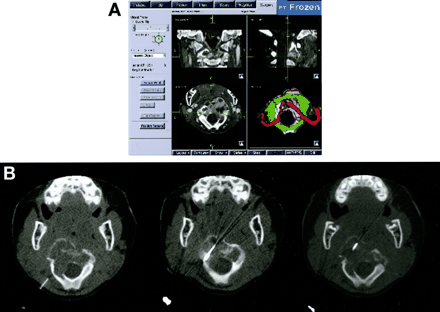 Fig 3.